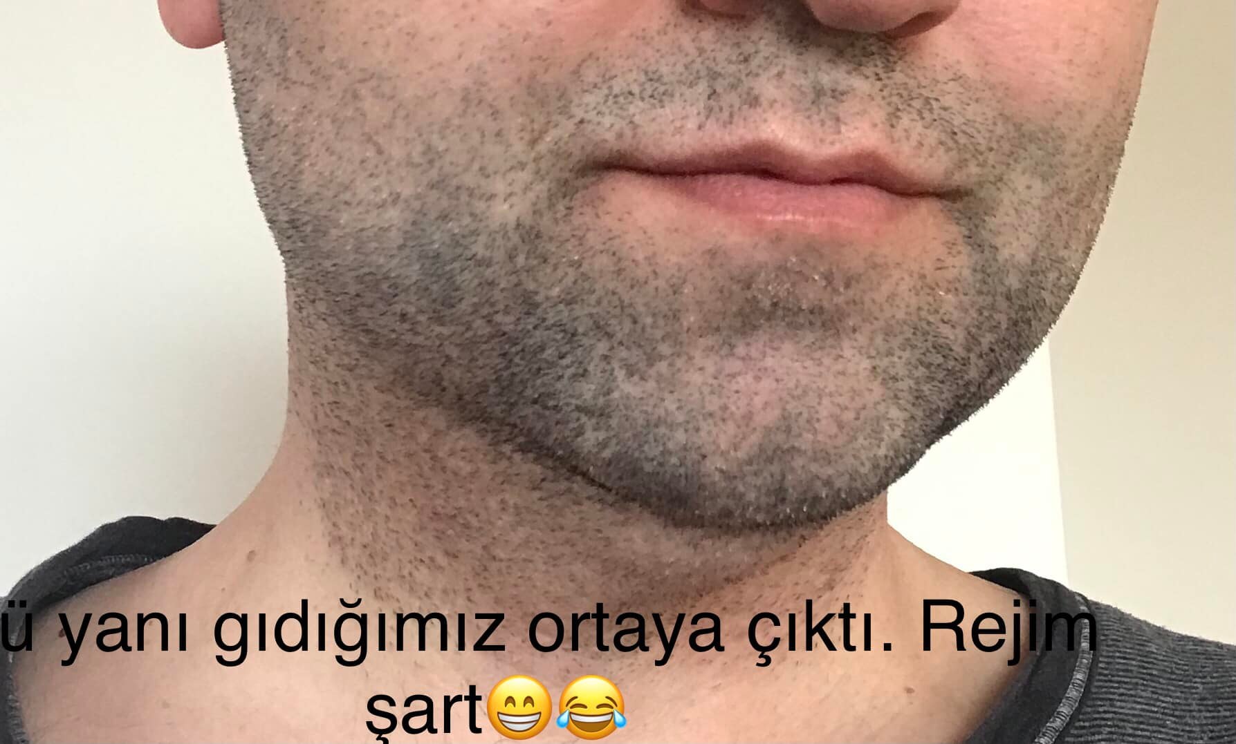 yanak alım.jpeg